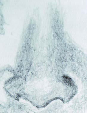 Figure 4 : Human nose b) Key difficulties identified 1) Mastery of drawing tools and materials had not been achieved in view of the limited use of drawing and shading styles seen in Figures 3 and 4.2) The strokes of the pencil reveal inexperience and lack of confidence of the students. The drawings show stiffness of the hands that held the pencil; they had not learned to relax the wrist muscles to achieve accurate drawings. 3) Of the many drawing and shading techniques, only outline drawing and mass shading techniques were used up to this level. 4) The drawings suggest lack of skill for critical simultaneous observation and drawing, hence, they had difficulty coordinating their hands and eyes.