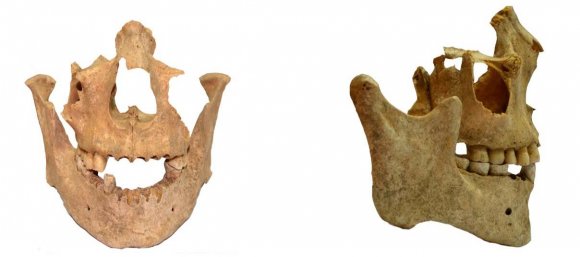 Figure 22: Craniological features of the individual from the mound 3